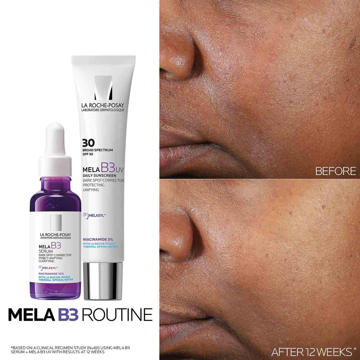Mela B3 UV Daily Moisturizer SPF 30 With Melasyl™ + Niacinamide 4 Mela B3 UV Daily Moisturizer SPF 30 With Melasyl™ + Niacinamide